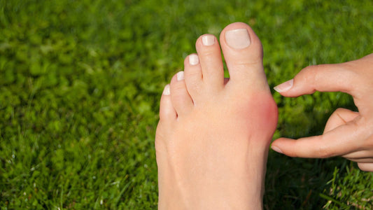 Hallux Valgus : 5 idées reçues qui empêchent de bien le traiter - FlexoCare