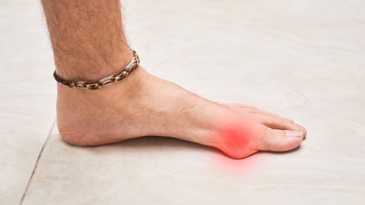 Hallux Valgus : Les erreurs du quotidien qui aggravent la déformation - FlexoCare
